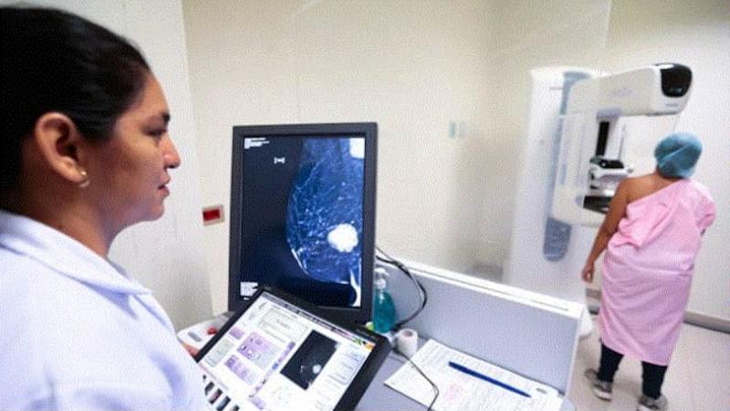 Cáncer de mama Cáncer de mama