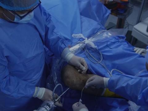 trasplante de meniscos